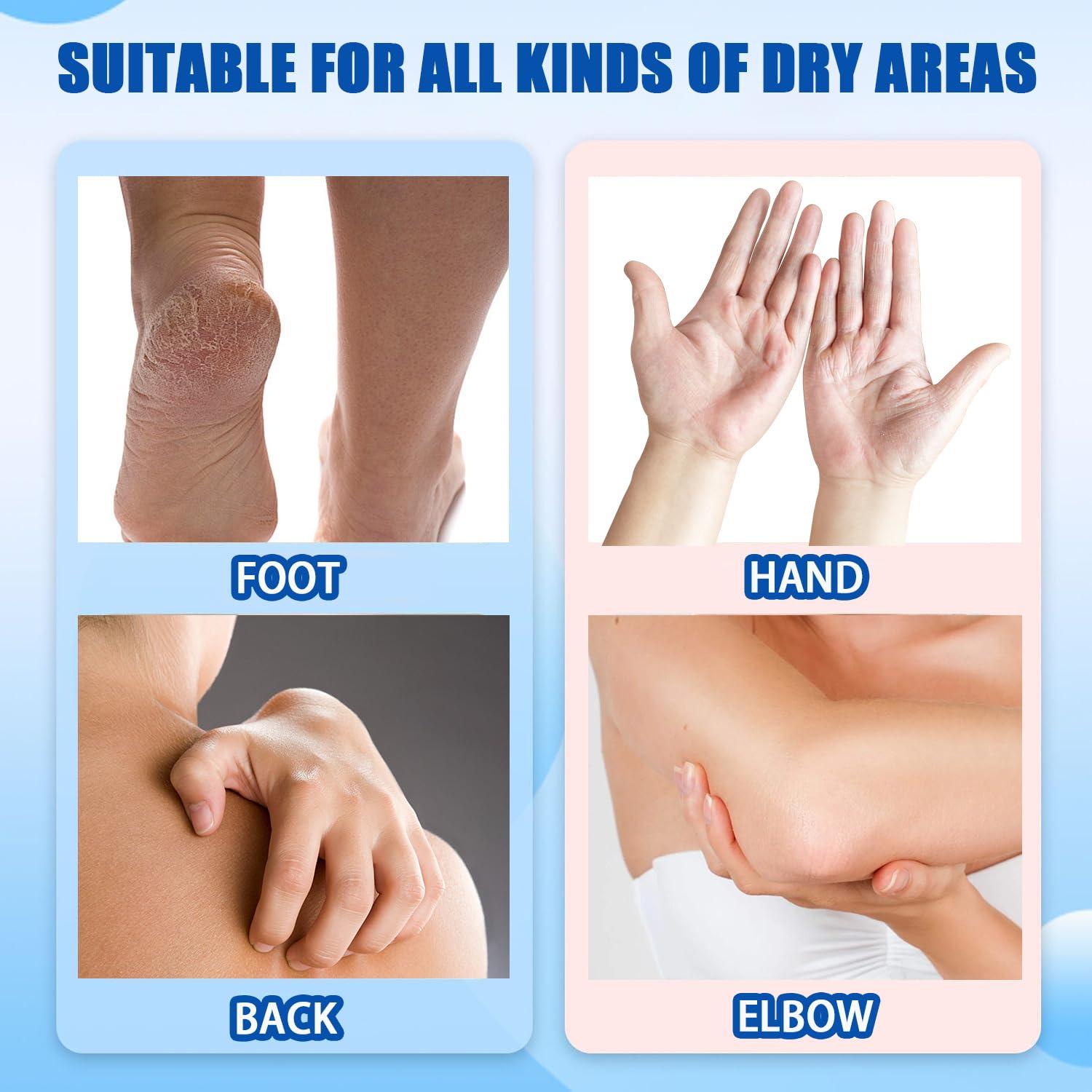 Buy one, get one freeCrack Feet Prevention Stick,2pcs Anti Crack Foot Cream For Dry Heels,Moisturizing Foot Balm Stick for Women Men Dry Heels Buy one, get one freeCrack Feet Prevention Stick,2pcs Anti Crack Foot Cream For Dry Heels,Moisturizing Foot Balm Stick for Women Men Dry Heels