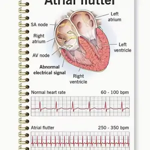 Atrial Fibrillation Cardiology Spiral Notebook, Heart Anatomy & Ecg Reference Journal, Medical Student Nurse Professional Guide