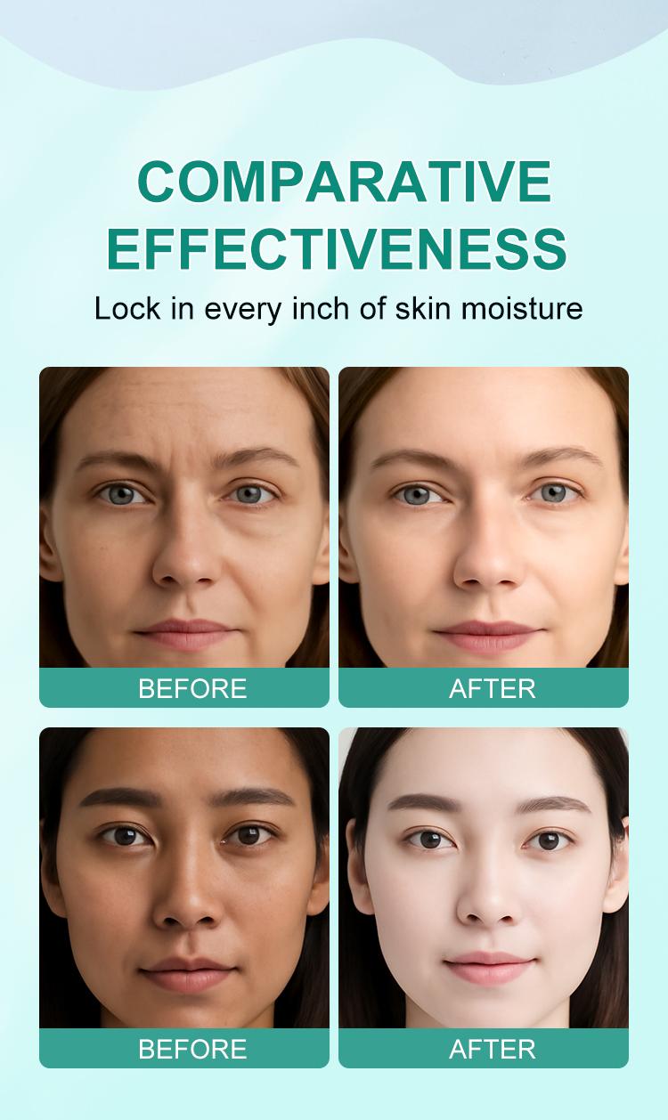 【BIYING】【FDA】2% Salicylic Acid 4-Piece Acne Travel Set | For Cystic & Hormonal Acne, Complete Cleanser Toner Moisturizer Kit, Unscented For All Blemish Prone Skin