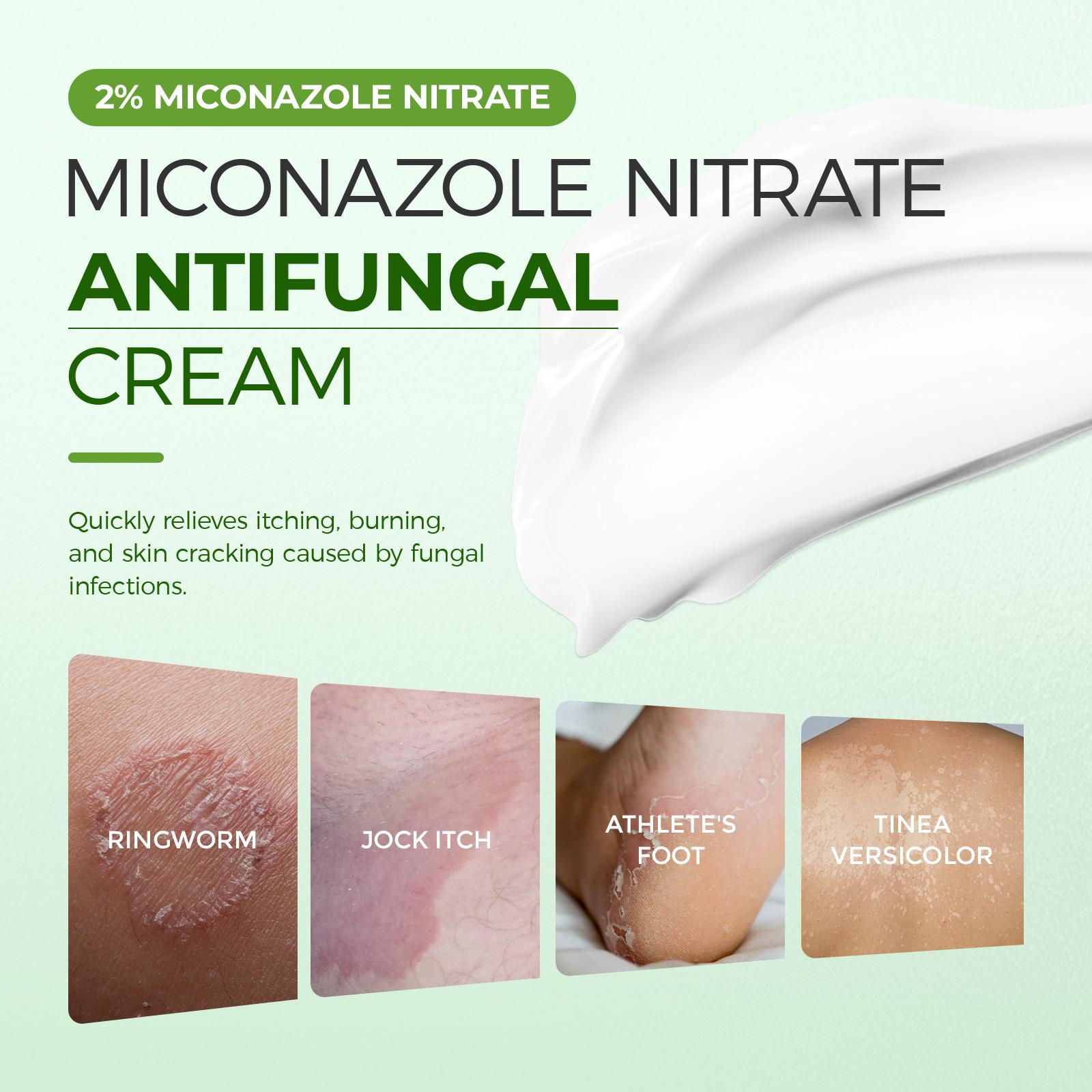 Inlifay Antifungal Cream, Advanced 2% Miconazole Nitrate for Athlete's Foot, Ringworm & Jock Itch. Effective Anti Itch Relief for Peeling, Cracked Skin & Sweaty Odor. Gentle Daily Foot & Body Care Routine for Men & Women