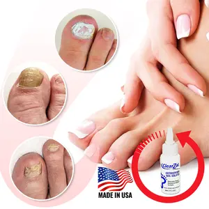 ClearZal BAC Antimicrobial Nail Solution,Advanced antifungal solution with benzalkonium chloride and aloe vera – prevents recurring fungal infections,Compliant Fungus Treatment for Toe Fungus, Discolored or Brittle Nails