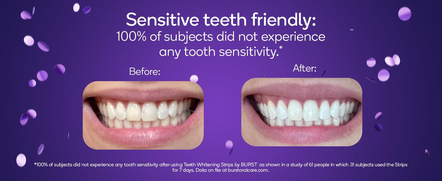 BURST Teeth Whitening Strips for Sensitive Teeth, No-Slip Grip, Dental White Strips Kit, 20 Strips, 10 Treatments, Visibly Whiter Teeth After One Use BURST Teeth Whitening Strips for Sensitive Teeth, No-Slip Grip, Dental White Strips Kit, 20 Strips, 10 Treatments, Visibly Whiter Teeth After One Use