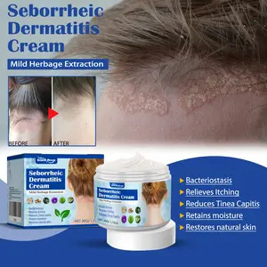 South Moon Skin Care Cream Gently Improve Scalp And Head Acne Skin Problems Care Cream Healthcare Therapeutic