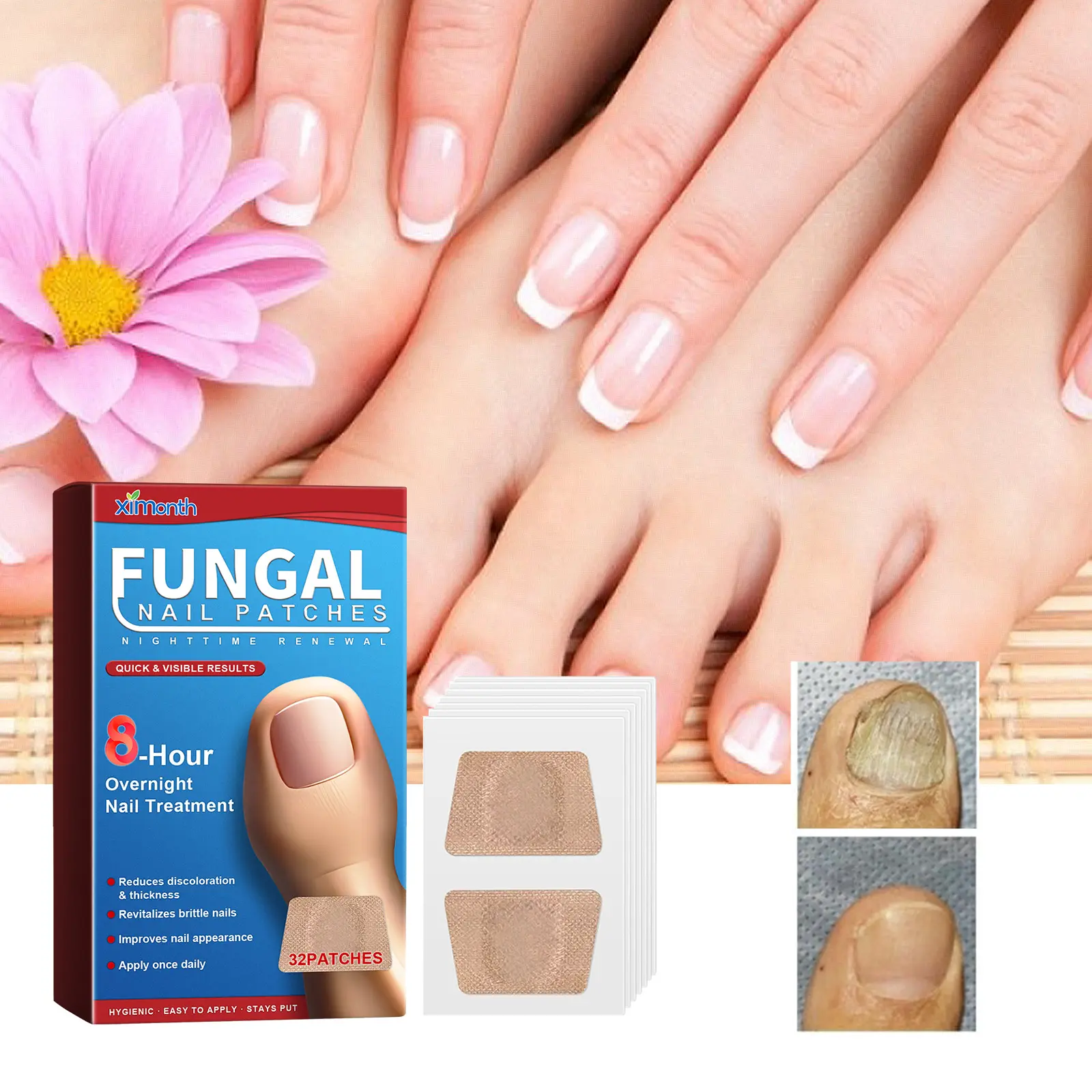 Ximonth Nail Repair Patches for Night Use – Strengthening Treatment for Cracked and Brittle Nails – 32pcs with Garlic Extract and Glycerin Gel Intensive Nourishing Peel nailgrowthoil