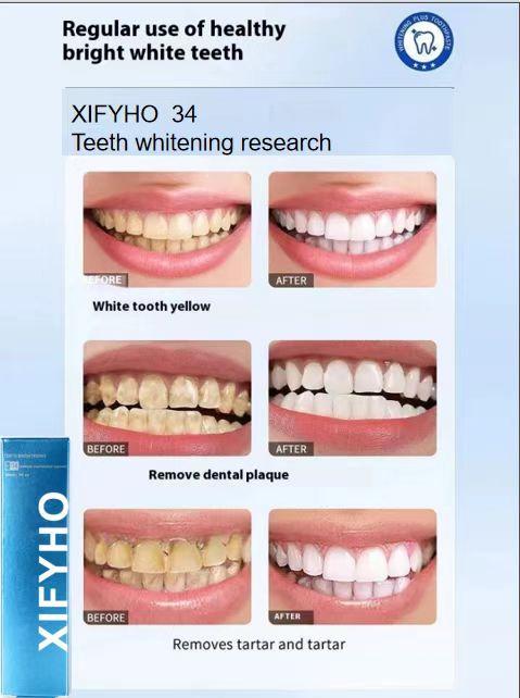 XIFYHO Cerulean blue Teeth Whitening Toothpaste, FreshenBreath Toothpaste for Oral Hygiene Clean,Daily Oral Health Care Cleansing Paste