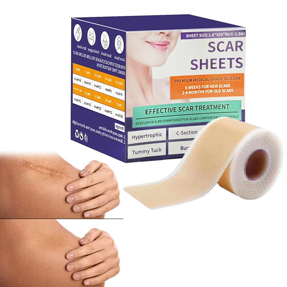 Silicone Scar Sheets(1.6"X 59" Roll-1.5M), Silicone Scar Repair Cream, Silicone Scar Tape, Silicone Scar Strips, Professional Scar Removal Sheets for C-Section, Acne, Buruns & Keloids, Suitable for All Skin Tayes