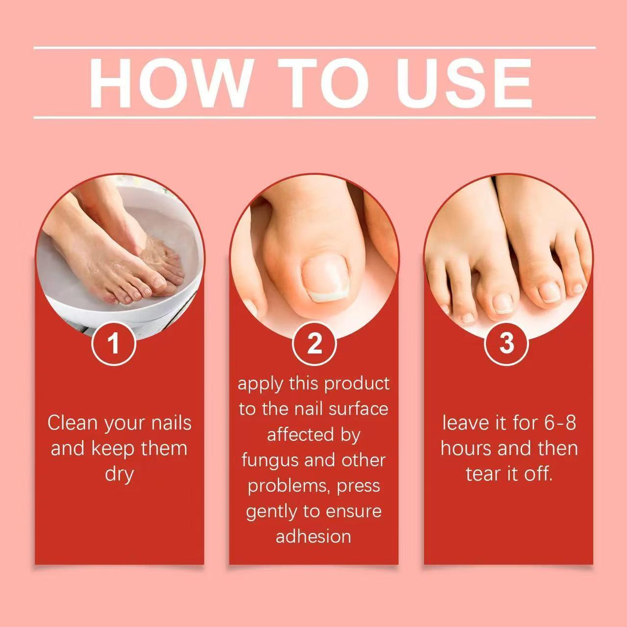 21-Count Overnight Fungal Nail Patches | Repair Brittle Discolored Nails, Fight Nail Infections & Restore Healthy Toenails