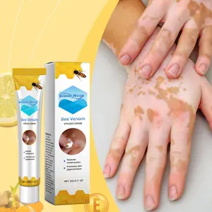 South Moon Vitiligo Care Cream, Gentle Body Massage Cream with Moisturizing, Nourishing & Skin Repair Benefits for Easy Application