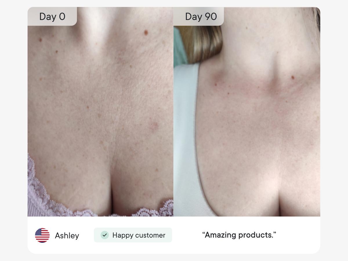 Qure Neck & Décolletage & Chest LED System, Red Light Therapy with 2 Wavelengths of Light, Red 633nm and Near-Infrared 830nmQure Neck & Décolletage & Chest LED System, Red Light Therapy with 2 Wavelengths of Light, Red 633nm and Near-Infrared 830nm