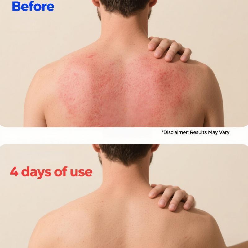 All-Natural Plant-Based Herbal Relief CreamSoothes Eczema, Psoriasis, Dry & Sensitive Skin I Ancient Botanical Formula for Whole Family Moisturizing Daily TikTokShopBlackFriday