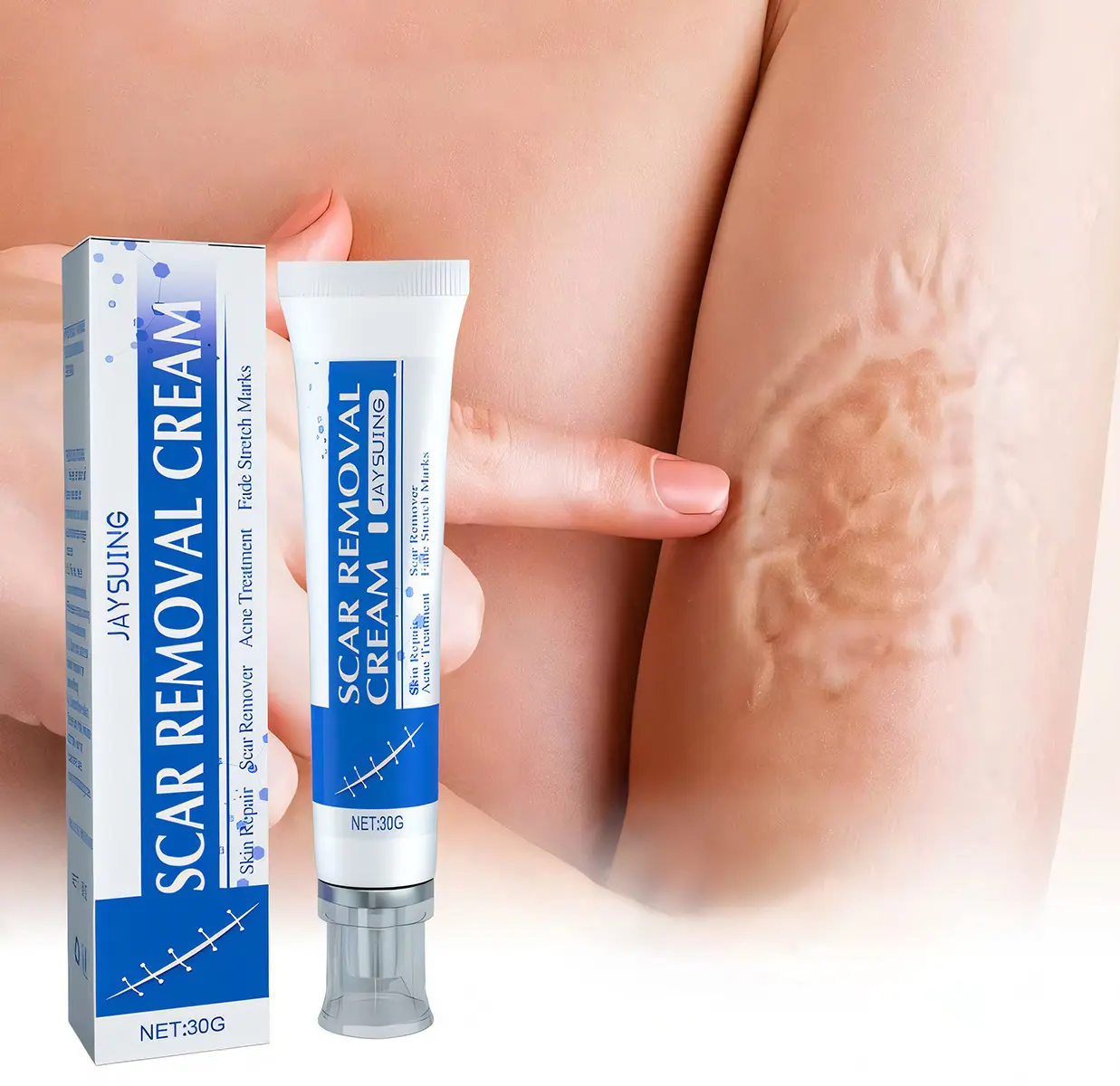 Professional Scar Removal Gel, Scar Repair Cream for Keloids, C-Sections, Surgeries, Burns (Beauty & Personal Care, Bath & Body Care)