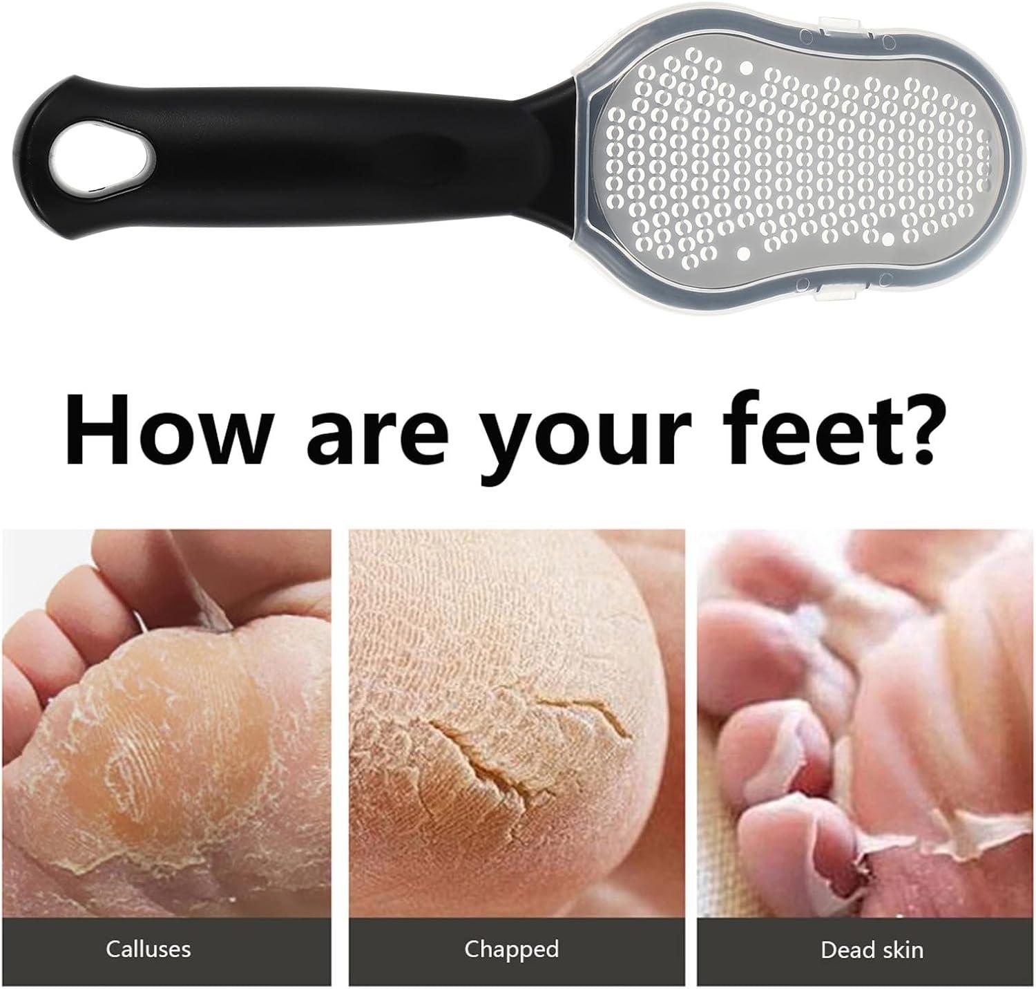 Callus Remover, Foot File for Wet or Dry Skin, Pedicure Tools,Gently Removed Callus and Dead Skin, Easy to Use (Pack of 1)