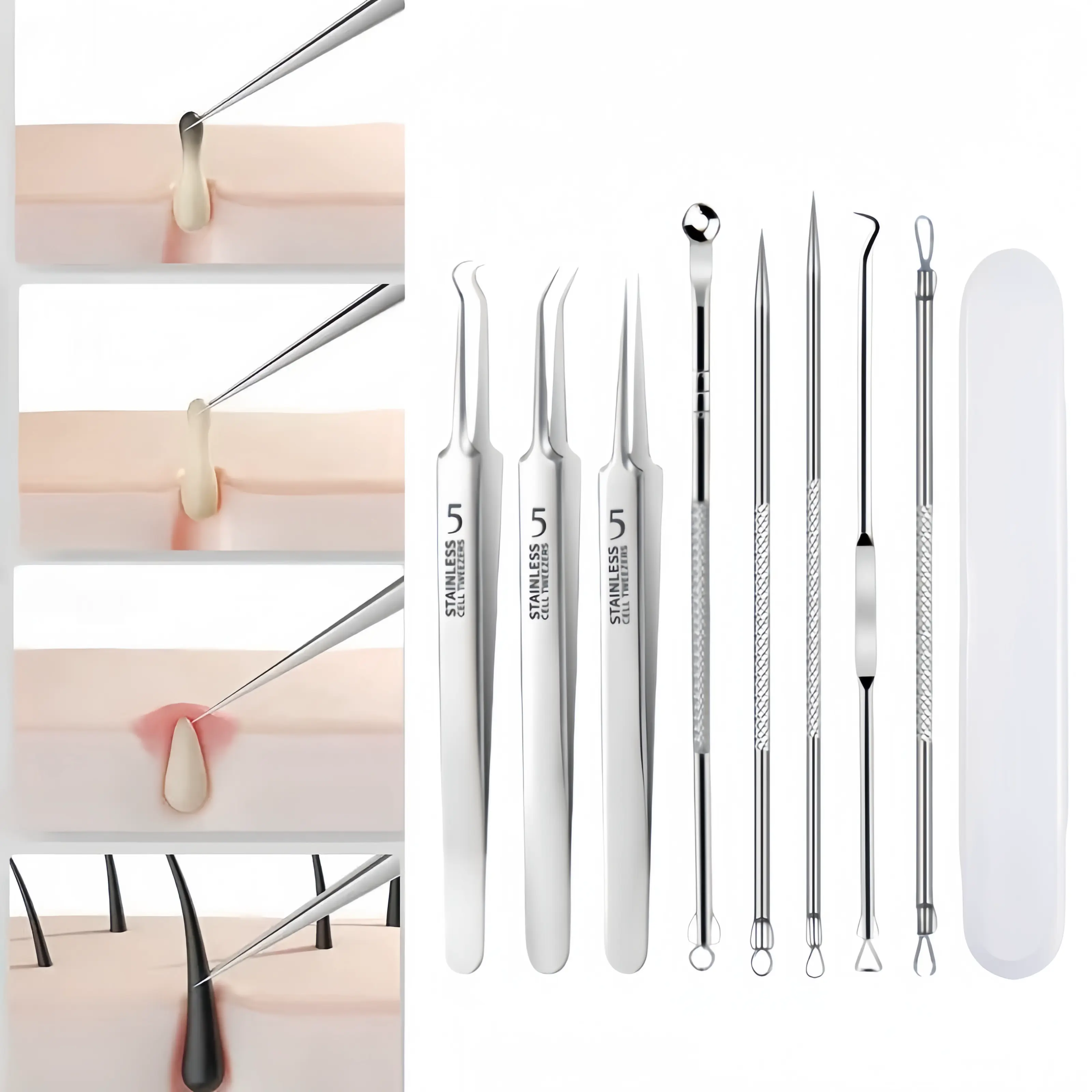 8-Piece Unisex Stainless Steel Blackhead Removal Tool Multi-Pack - Precision Acne Squeezer, Needle & Glue Box, Hypoallergenic Facial Cleansing Tool for Acne Care, Home Skincare Essential for All Skin Types