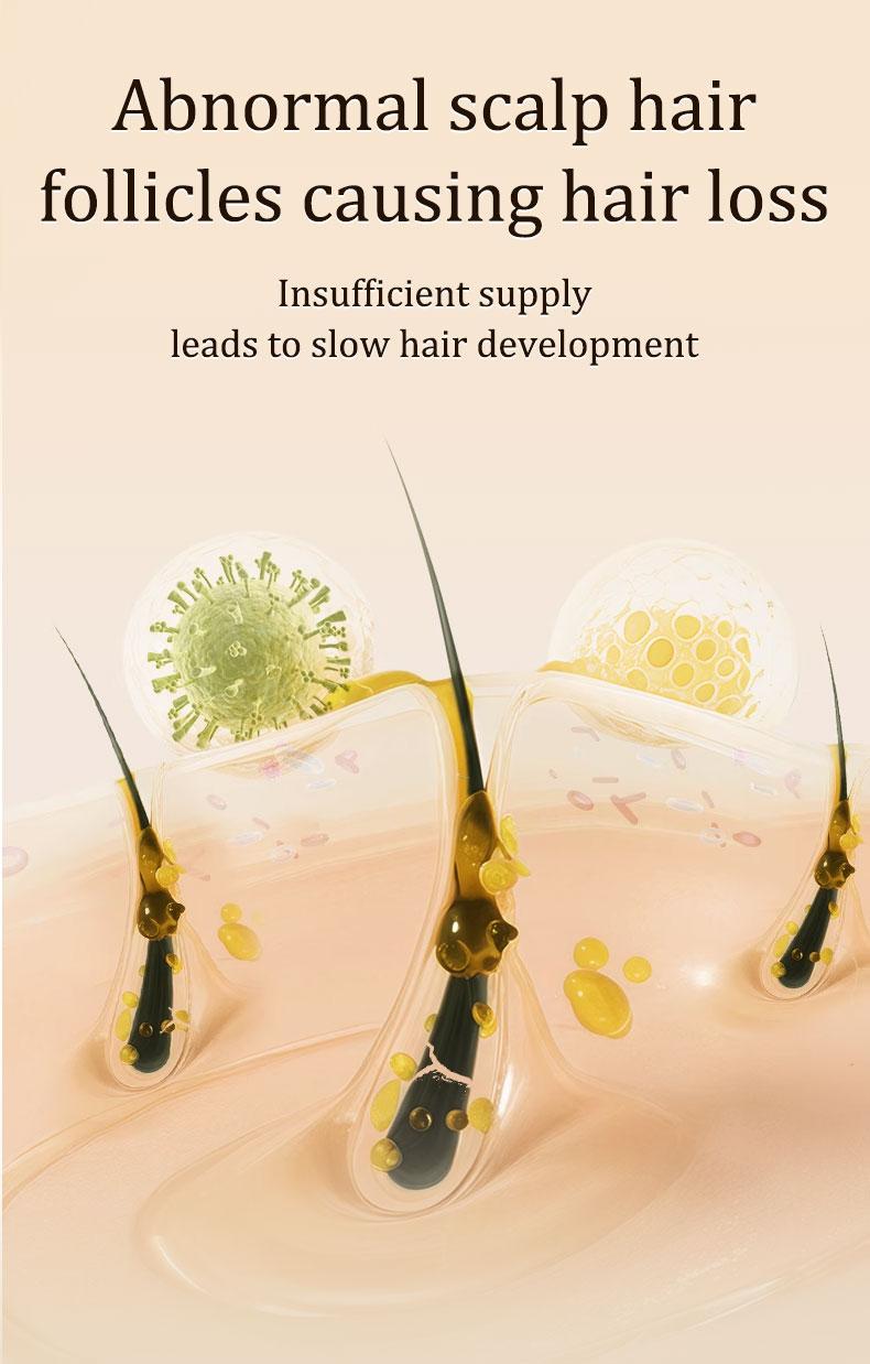 Gypsophila Batana Oil&Rosemary Oil - Hair Growth, Nourish Scalp & Detox for Strong & Healthy Hair - 30 mL Haircare with Organic Batana nourish hair natural oil Gypsophila Batana Oil&Rosemary Oil - Hair Growth, Nourish Scalp & Detox for Strong & Healthy Hair - 30 mL Haircare with Organic Batana nourish hair natural oil