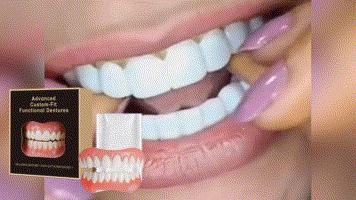 Smile Boosting Dental Veneer Kit Daily Use Teeth Shaping and Whitening Set for Natural and Beautiful Smile Enhancement