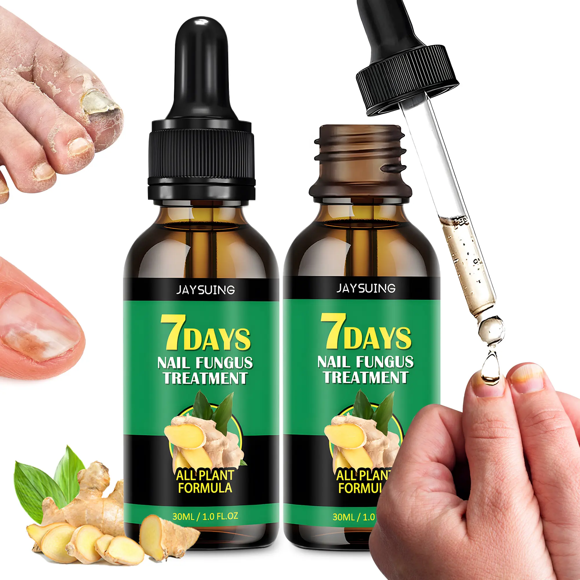 2Pcs Ginger Nail Treatment, 7days Nail Growth Serum Solution, Ginger Cuticle Care Oil for Nails Strengthener, Promote Nail Healthy Grow(30ml/1 FL.OZ)