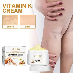 Varicose Veins Miracle Cream, Vitamin K Cream, Varicose Vein Miracle Cream, Varicose Vein Cream
