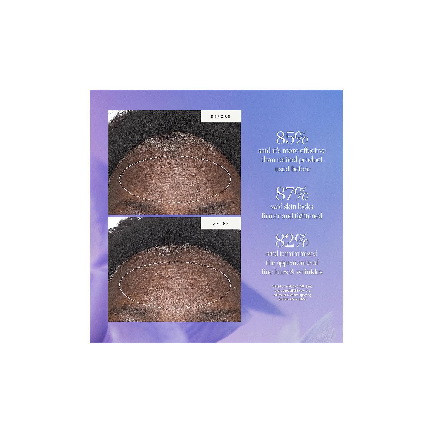 KORA Organics Plant Stem Cell Retinol Alternative Moisturizer