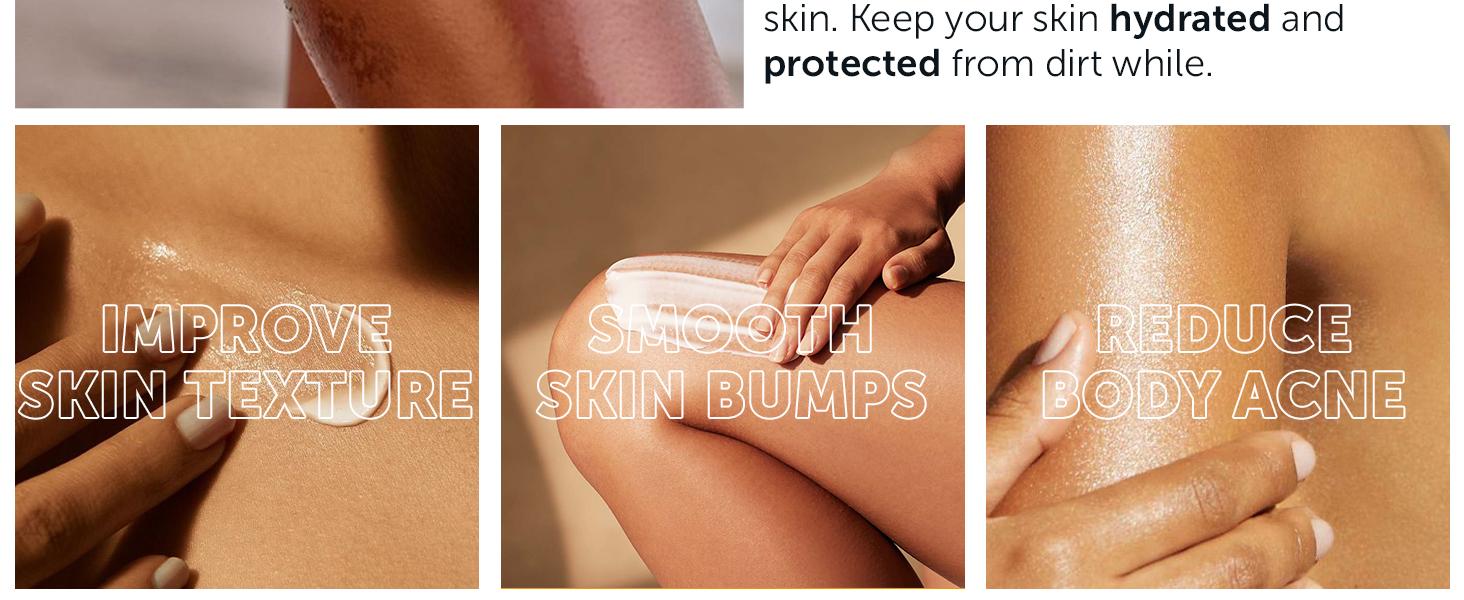 Keratosis Pilaris Treatment | Keratosis Pilaris Lotion with 10% AHA | Gentle Exfoliation For Strawberry Legs, KP & Ingrown Hairs | Smooth & Hydrating Body Lotion For Redness, Dry, Rough And Flaky Skin