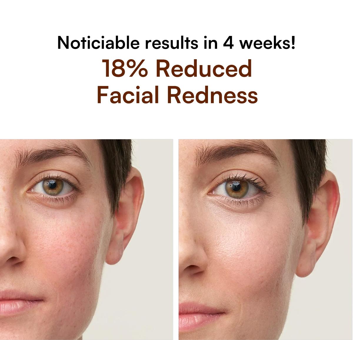 INIA GLOW Wireless LED Mask, Perfect Gift Season Pick,  Live Stream Only BUY 1 GET 10 with FLARE and 8pcs Collagen Real Deep Mask