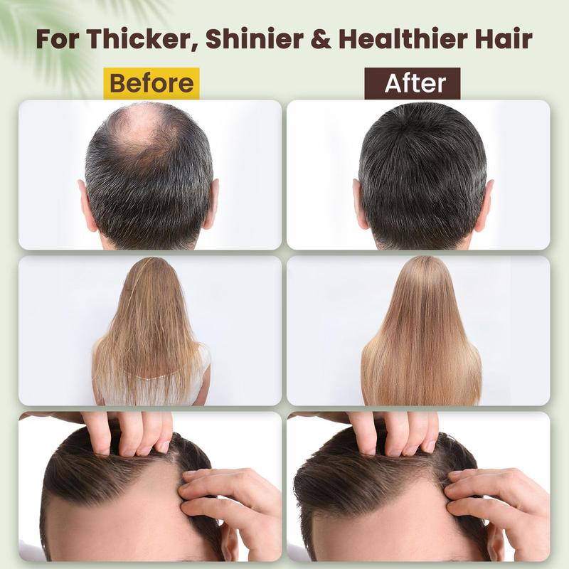 Raw Batana Oil for Hair Growth: 100% Organic, Dr. Sebi Approved | Prevents Hair Loss, Eliminates Split Ends | Scalp & Hair Care for Women & Men