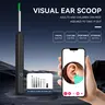 Gift Ear Pick with LED Light & Camera – Safe, Hygienic Ear Wax Removal Tool. 360° Rotation, High-Res Viewing, Waterproof Tip. Perfect for Home Use!