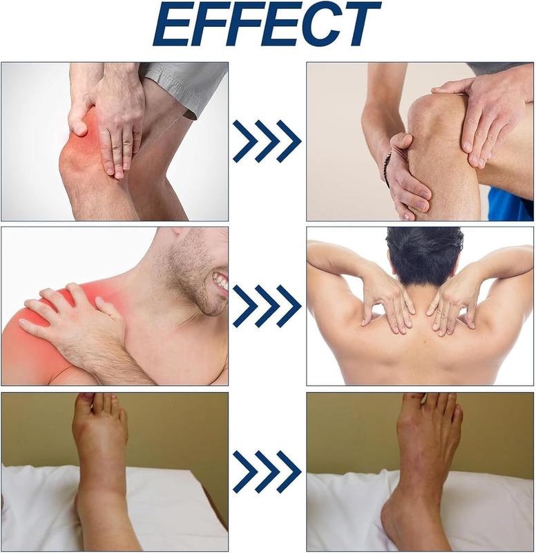 Neuropathy Relief Neuropathy Relief Cream | Neurosoothe Formula Nerve Cream, Capsicum Pain Relief Cream, Contains Capsaicin, Arnica, Menthol, Msm, And Glucosamine, Suitable For Feet, Hands, Legs, Muscles, Joints, And Waist | 100g