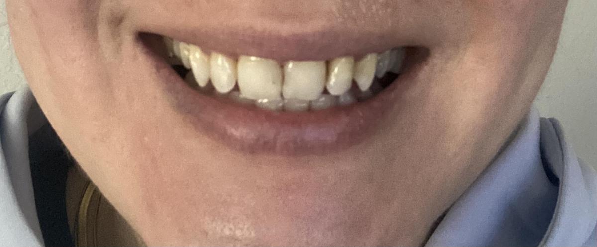 Item: 1 PACK -14 STRIPS