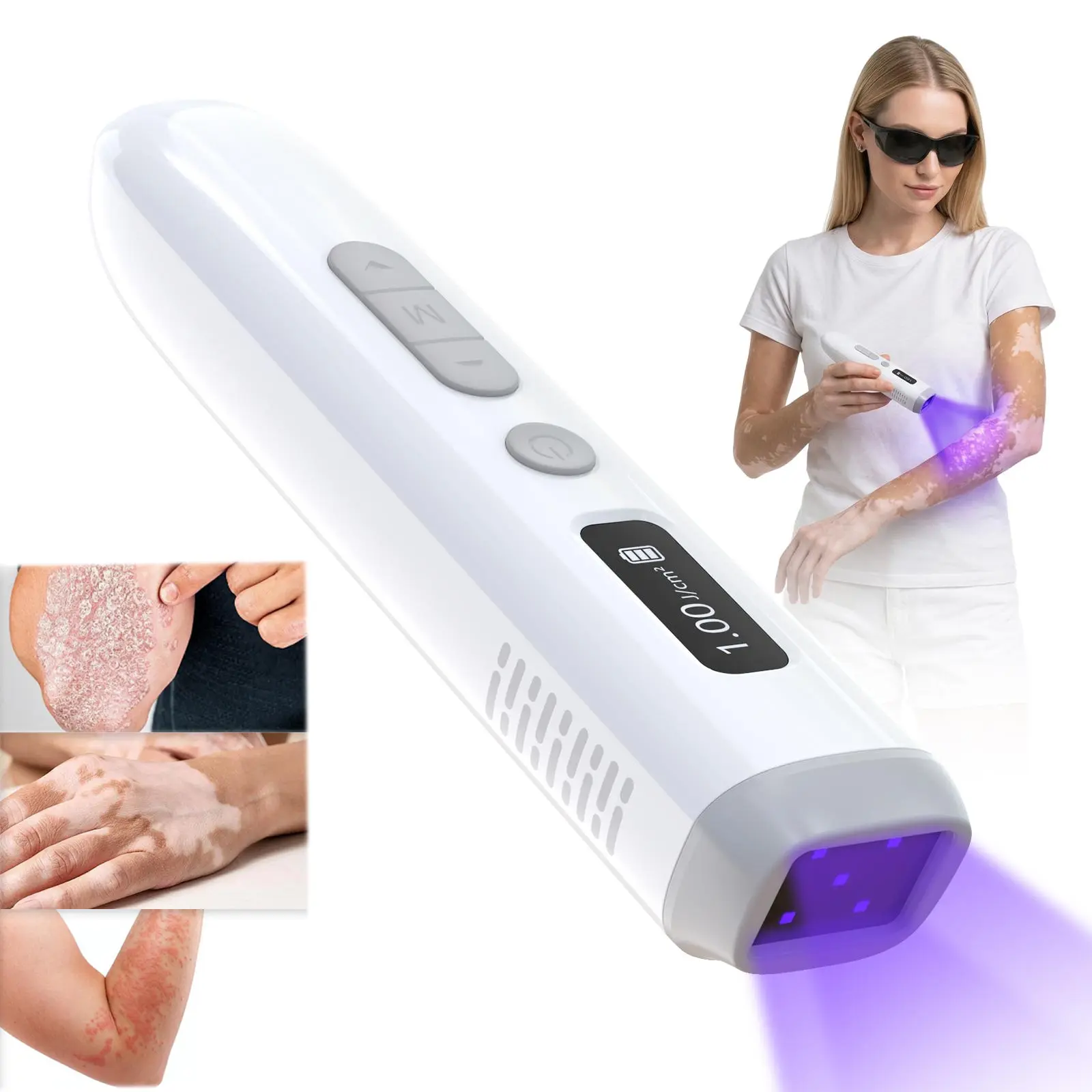 Pen-Sized 308 nm UVB Light Therapy Device - Adjustable Dosage, Compact Portable, Skin Targeting Personal Care Appliance with Countdown Timer for Vitiligo, Psoriasis Treatment (Skin Health Accessory)