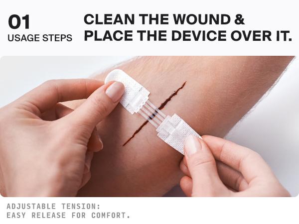 SURVIVEX Wound Closure Kit - Non-Invasive Skin Healing Solution for Cuts & Wounds - Gentle, Adjustable Tension, No Scarring, Easy Removal - All-in-One Emergency Healthcare Aid