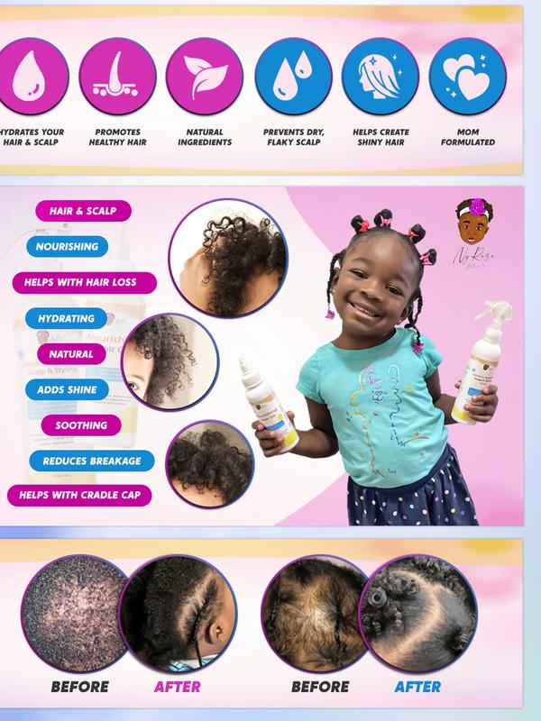 NyRose Naturals Complete Dry Hair & Scalp Solution - Natural Leave-In Hydrating Spray, Nourishing Hair Oil, & African Black Soap Bar for Cradle Cap & Post Partum Hair Loss