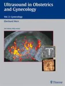 USED-Ultrasound in Obstetrics and Gynecology: Volume 2: Gynecology by Merz, Eberhard (Plastic Comb)