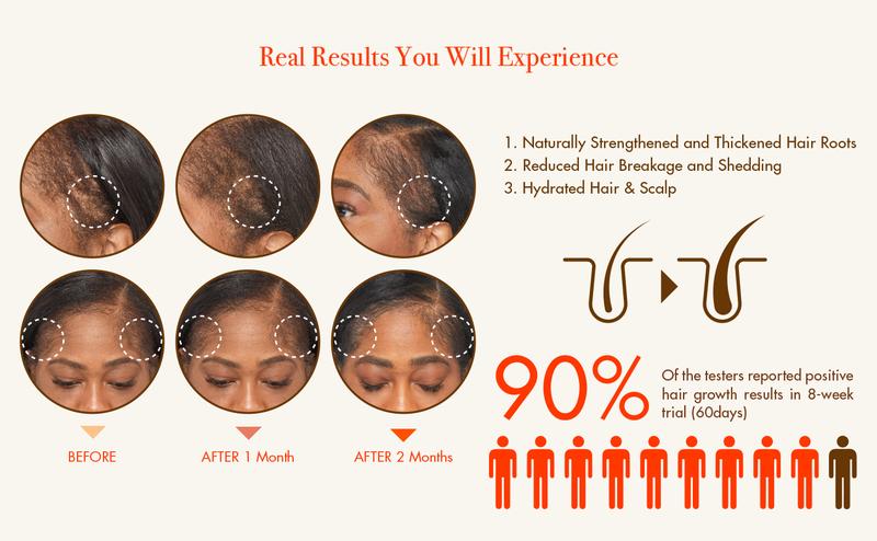 RED BY KISS Growth MD Scalp Ampoule, Hair Growth Strengthening 10X Biotin & Rosemary Oil Infused, 100% Natural Ingredients, USDA Certified Organic Oils Haircare