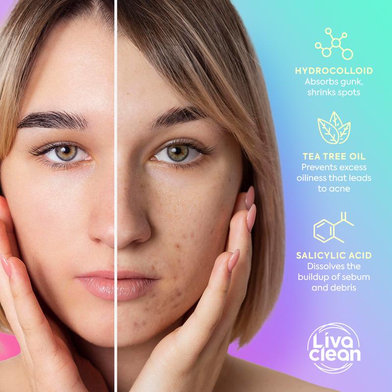 240ct Pretty Pastels Pimple Patches