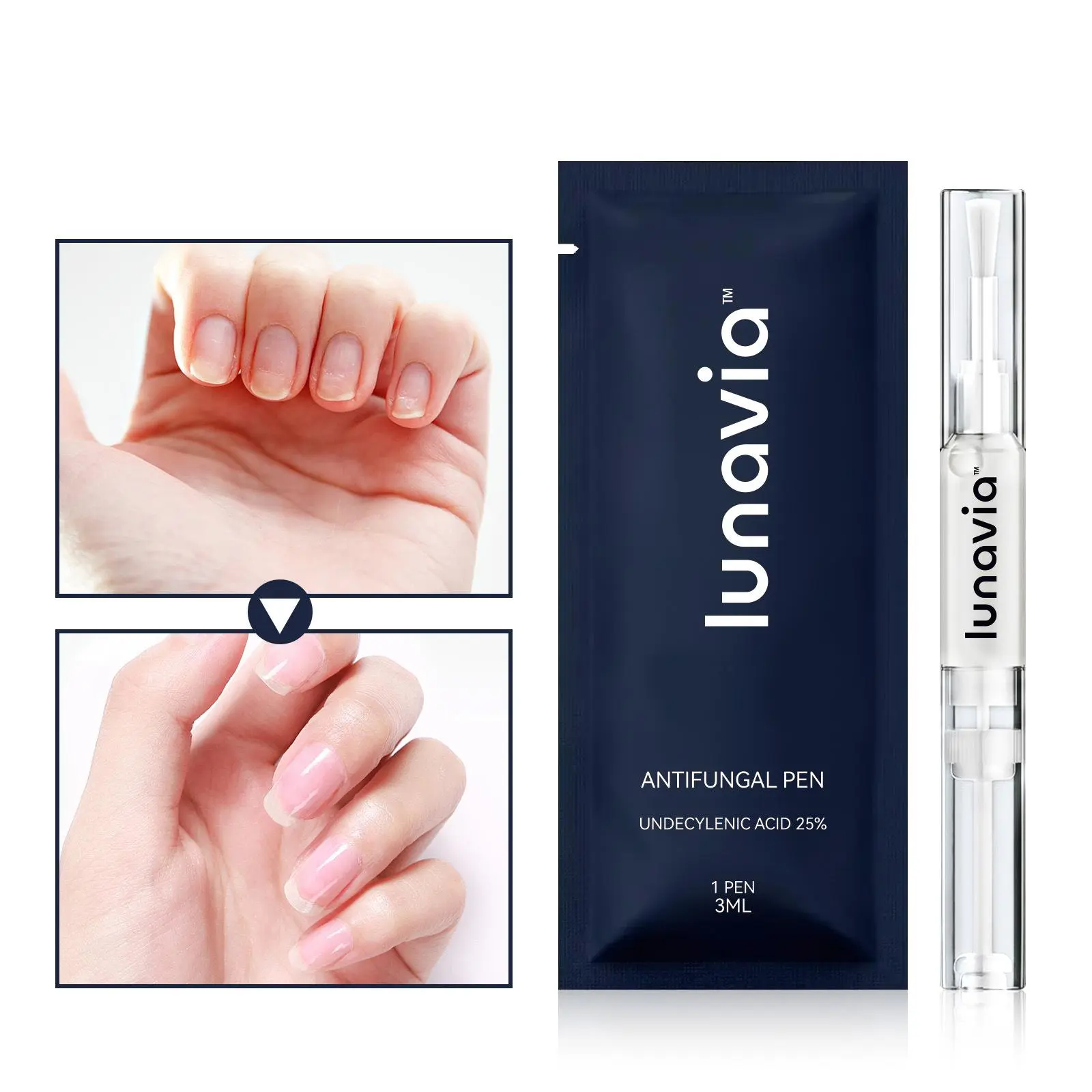 antifungal pen Lunavia Antifungal Pen . UNDECYLENIC ACID 25%25-Cures Most Athlete's FootJock ltch, and Ringworm