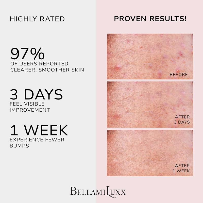 BellamiLuxx Butt Acne Clearing Treatment Cream: Body Acne Treatment for Folliculitis and Pimples on Buttocks, Thighs With 2% Salicylic Acid & Tea Tree Oil - Butt Cream for Smooth Skin