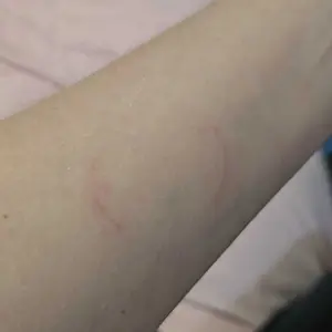 Kind Patches, Defence Patches, 30 Immune Boosting Patches: Natural Ingredients, Essential Nutrients, Vegan, 1 Month Pack