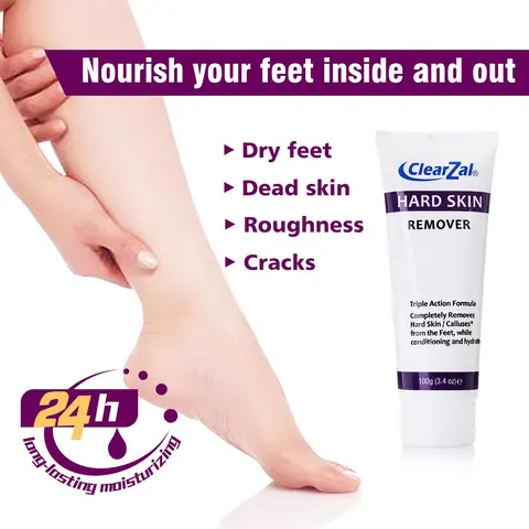 Clearzal  Dry Cracked Feet Repair UltraHydrating Hand and Foot Cream Crusty Moisturizer, 3.5 oz. Contains Urea, Salicylic Acid, for Dry, Chapped, Cracked Feet, Dead Skin Antibacterial combination