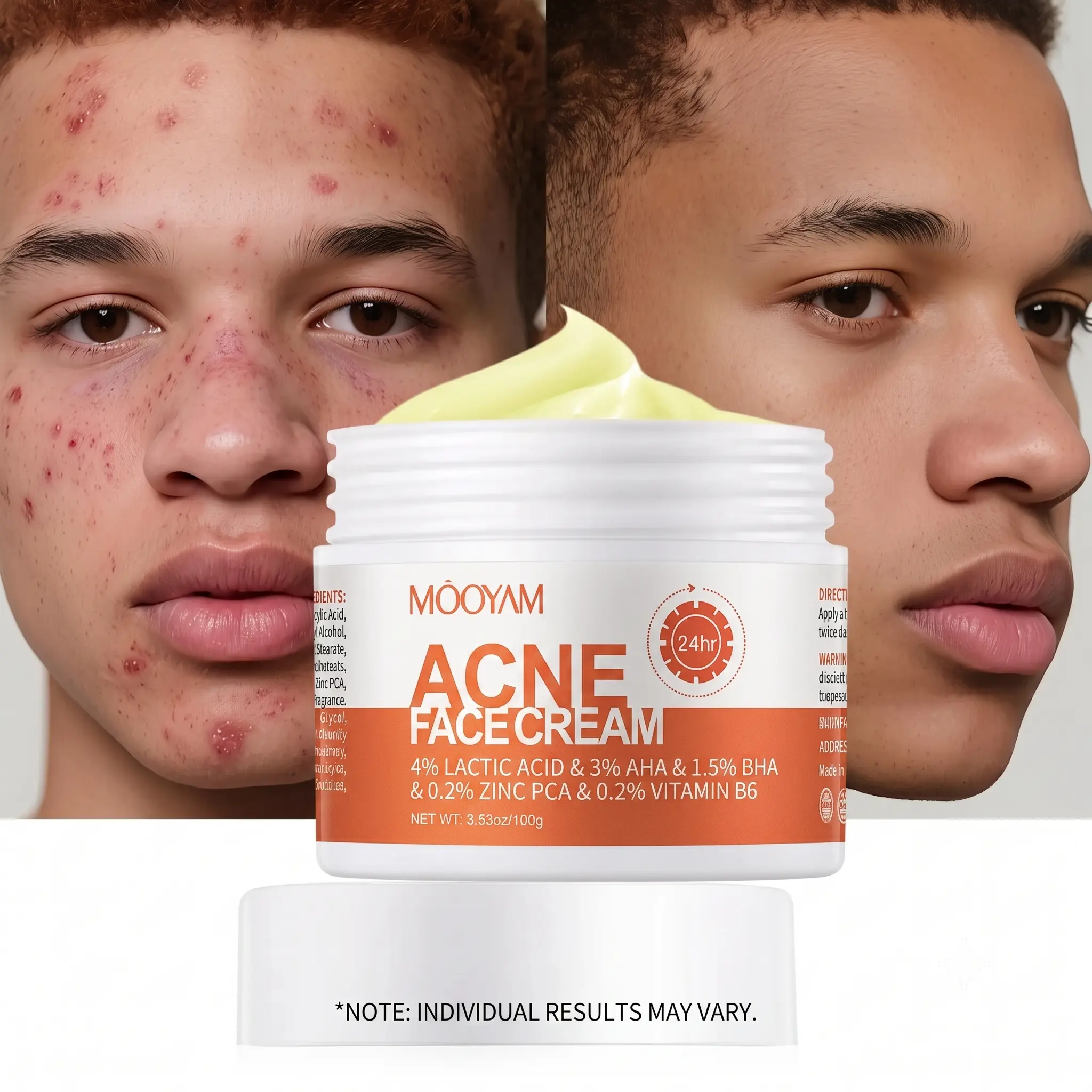 MOOYAM Snail Mucin & Centella Blemish Cream, Tea Tree Clear Skin Moisturizer for Sensitive Skin