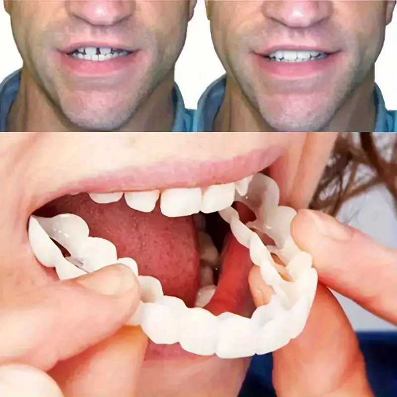 Plaid Fake Teeth Grillz for Adults, 4-Piece Adjustable Plastic Cosmetic Teeth Brightener Set, Sporty Chic Style for Cosplay with Case