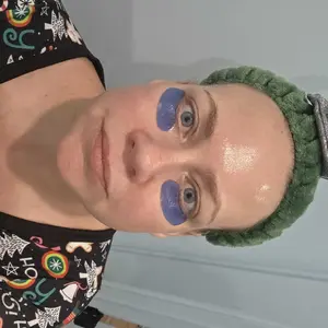 Product Review of Qure Micro-Infusion Anti Wrinkle Patches for Smile Line, Frown lines, Under Eye Bags, Puffiness, Crow's Feet - Retinol, Niacinamide, Caffeine, Peptides - Dissolvable for Overnight Use - 8 Pairs from J**3