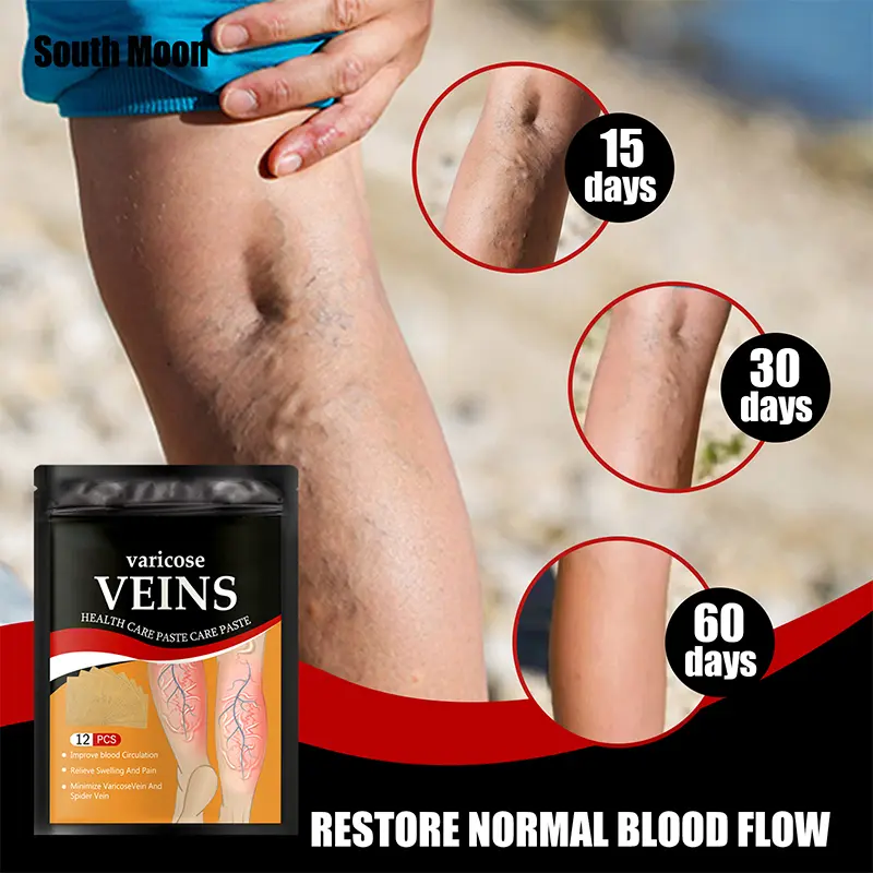 Varicose Veins Relief Patches with Cold Compress - Natural Healthy Solution for Leg Pain, Blood Clots, Swelling - Beauty & Personal Care Therapeutic Wellness Aid