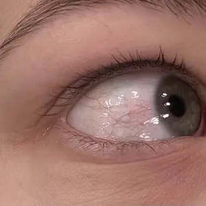 Product Review of FORCHICS Eyelash Enhancing Serum with Powerful Peptides & Plant Botanicals for Thinning Lashes 3ML Makeup Cosmetic from 𝓜**🦆