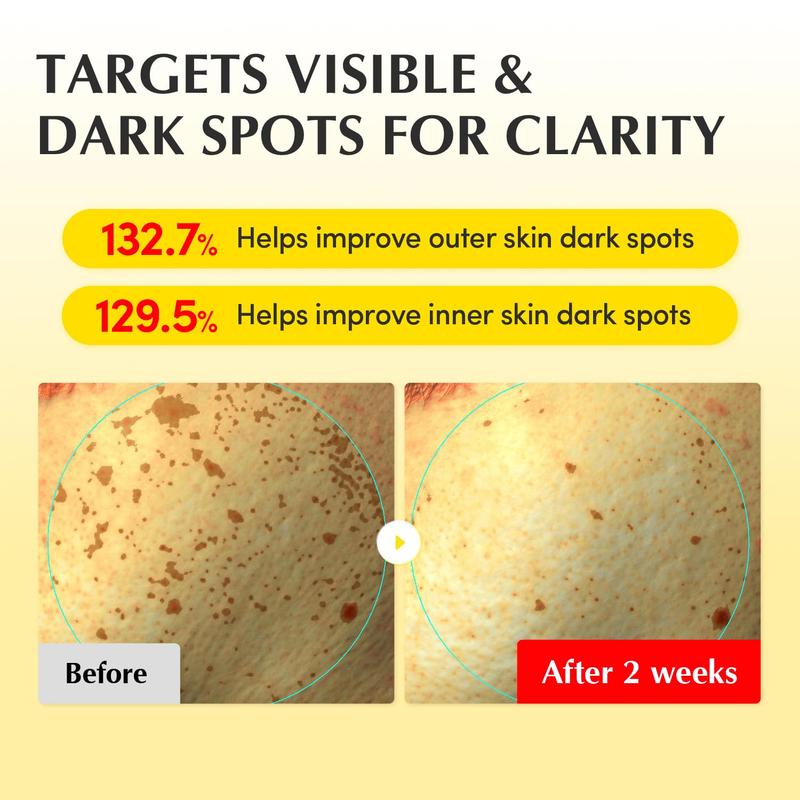 EQQUALBERRY Vitamin Illuminating Cream – Vitamin C & 5% Niacinamide + 3% TXA | Dark spots Cream | Ceramide Barrier Strength | Glowy, Lightweight Hydration (1.69 fl.oz / 50ml)