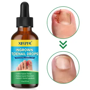 XIFEPFR Ingrown Toenail Treatment, Ingrown Toenail Reliever and Softener for Easy Trimming, Ingrown Toenail Remover, Ingrown Toenail Corrector Drops, 30ml
