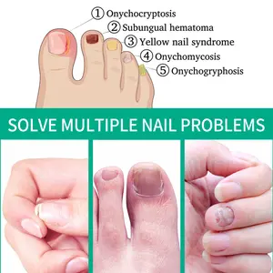 Nail Care Serum Nail Strengthener for Damaged Nails Cuticle Oil Moisturizing Nail Repair Essence Improves Nail Appearance Smooth Shine Daily Nail Care