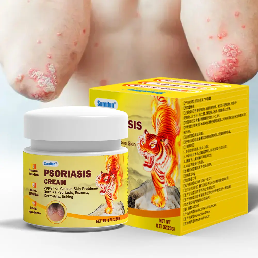 Sumifun Psoriasis Cream for Adults - Hydrating, Soothing Eczema Lotion, Moist Hand Lotion for Psoriasis, Eczema, Dermatitis and Itching (Hand & Body Use), Moist Hand Lotions