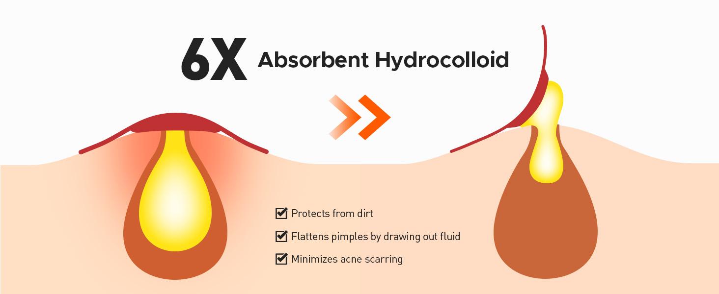 TKTK Hydrocolloid Bandages, 45 x 45 mm Large Pimple Patches for Face, XL Acne Patches for Body, Back, Forehead, Cheek Zit Breakouts, Big Hydrocolloid Patch (Square, Strip, Dot 5 Sizes 120 Count)