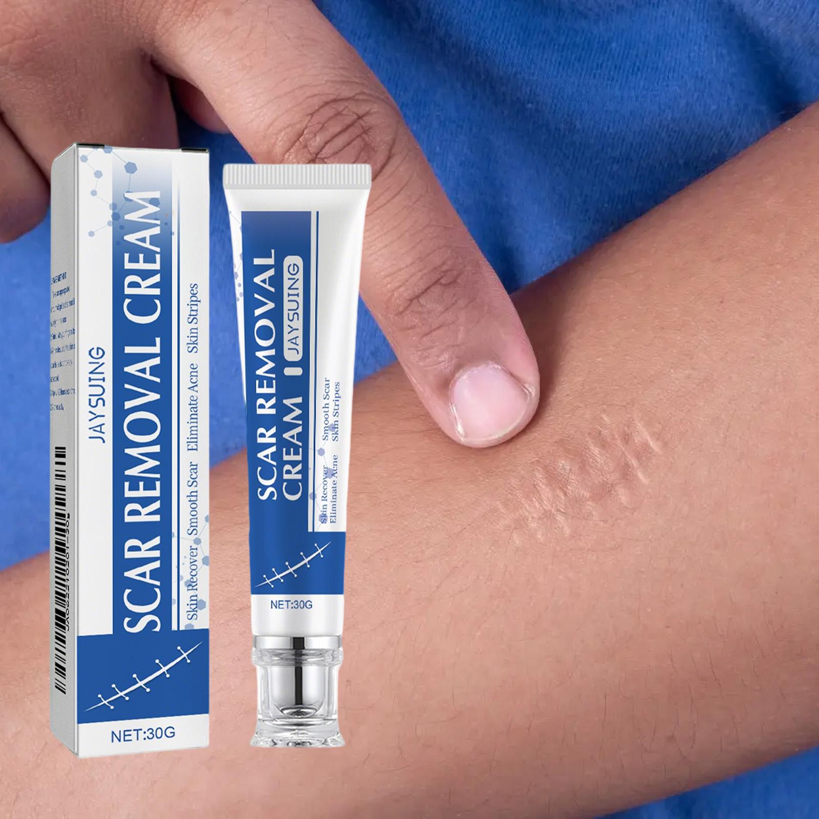 Advanced Scar Removal Cream for Old & New Scars - Silicone Gel Formula for Surgical, Acne, Keloid, Burn & Stretch Mark Repair, Smooths & Hydrates Skin, 30g