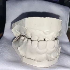 Teeth molds